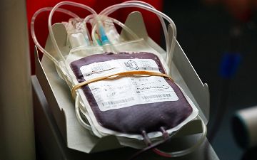 В Узбекистане отменили требование быть обязательным родственником для донорства 