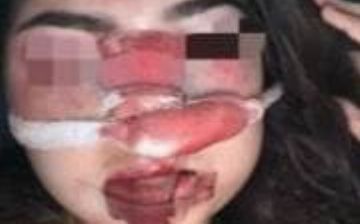 В Узбекистане налоговик избил и преследовал свою супругу