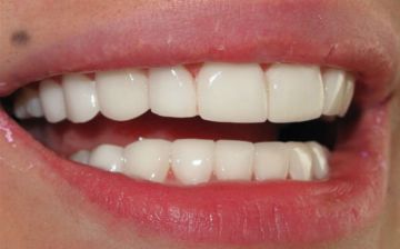 Врач рассказала, как недорого улучшить состояние своих зубов