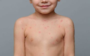 Стало ясно, как проявляется «омикрон»-штамм у детей — подробности