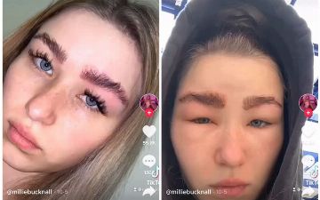 У девушки-блогера распухла голова после одной из салонных процедур для бровей — видео