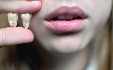 А вы знали, что зубы мудрости у обезьян вырастают раньше, чем у людей — объясняем, почему