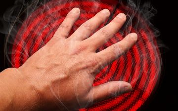 Как врачи определяют процент ожога тела — рассказываем