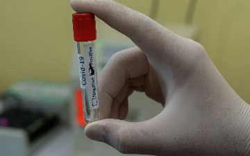 Где в Ташкенте можно бесплатно сдать ПЦР-тест