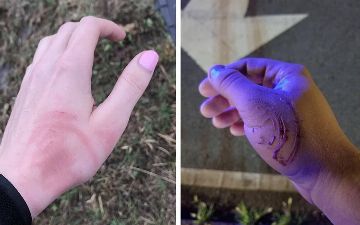 У водителей новый «кровавый» тренд, связанный с подушками безопасности