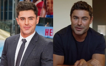 Зак Эфрон рассказал, почему его лицо деформировалось