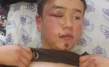 СМИ: В Кашкадарье депутат избил школьника из-за свидания с внучкой