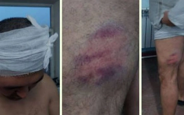 В Андижане избили водителя, возмутившегося пропусками без очереди на газовой заправке