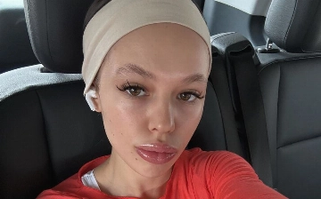 Инстасамка решила уменьшить губы