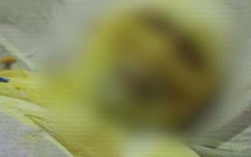 В Ташкенте мужчина облил себя спиртом и поджег