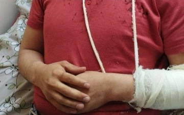 В Андижане толпа мужчин избила врача, оказавшего помощь пациентке 