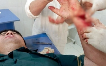 В Сурхандарье пьяный дебошир чуть не оставил участкового без руки