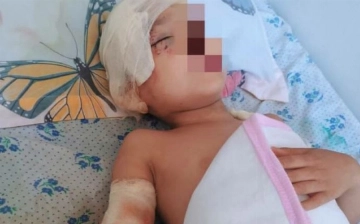 В Андижане стая собак напала на оставшегося без присмотра мальчика