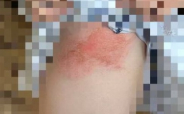 Житель Ташобласти избил и пытался поджечь бывшую жену