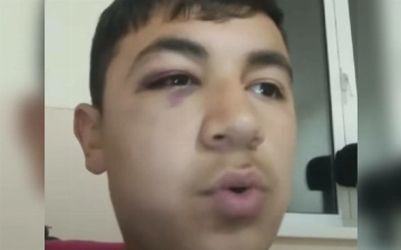 В Кашкадарье педагог избил ученика до сотрясения мозга