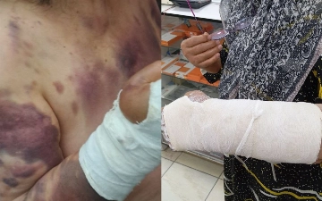 В Ташкенте помощник хокима жестоко избил свою мать