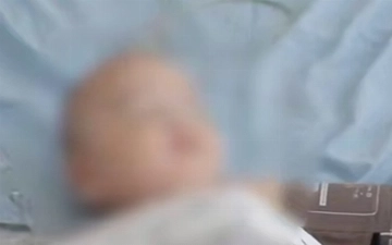 В Ташкенте маленькому ребенку удалили часть кишечника: до этого его накормили фастфудом