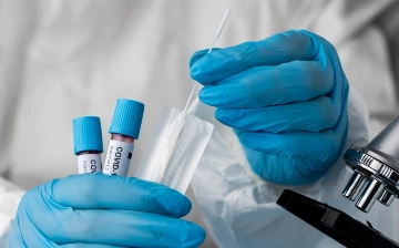 В Санэпидкоме рассказали, стоит ли узбекистанцам опасаться нового штамма коронавируса «Цикада»