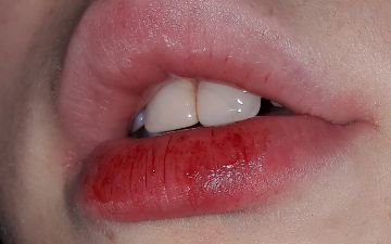 Почему мы кусаем губы и как от этого воздержаться?