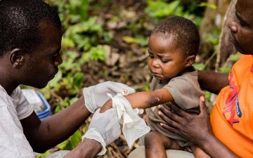 Что известно об оспе обезьян на данный момент