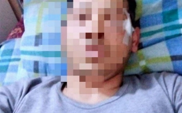 Под Ташкентом избили прибывшего на вызов врача