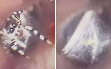 В Китае паук сплел паутину в ухе пенсионерки и прожил там неделю