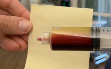 Так выглядит кровь с повышенным содержанием жиров — что к этому приводит?