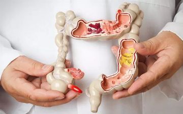 Ученые определили пользу аппендикса для здоровья