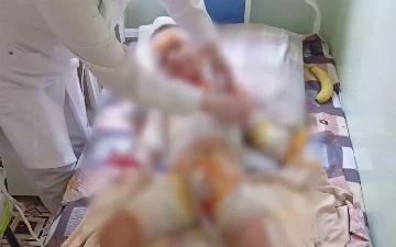 В Фергане воспитанник детсада получил удар током: возбуждено уголовное дело 