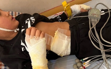 Блогер рассказал о состоянии мальчика, которого ударило током при спасении щенка