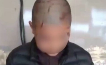 В Ургенче мужчина жестоко избил 14-летнего сына