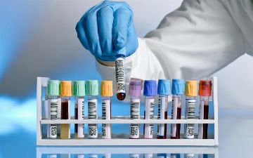 Врач назвал анализы, которые нужно сдать людям, перенесшим коронавирус