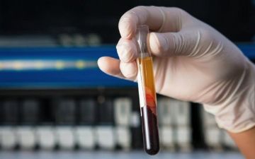 Создан тест, выявляющий рак до появления симптомов