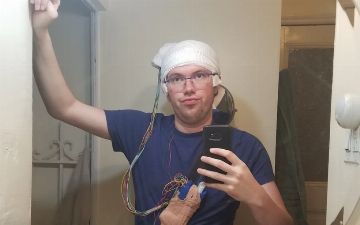 Мужчина из Нью-Йорка удалил часть мозга и стал бесстрашным 