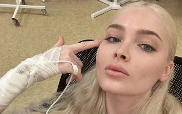 Алена Шишкова рассказала, как лечилась от анорексии и булимии