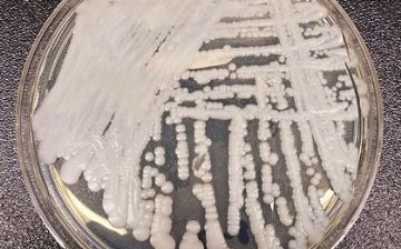 В Бразилии сообщили о первом в стране случае заражения опасным грибком