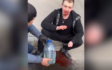 Известный российский рэпер Yung Trappa попал в аварию и остался без зубов