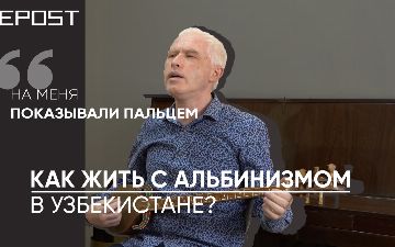 Жизнь альбиноса в Узбекистане — с какими проблемами он сталкивается? — видео