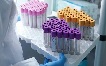 В Узбекистане началось тестирование на иммунитет к коронавирусу