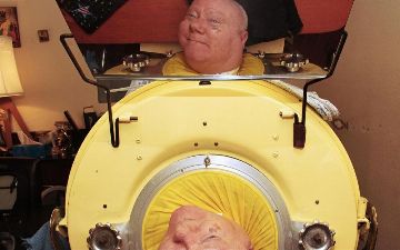 Из-за редкой болезни мужчина живет в специальном аппарате всю жизнь — что с ним?