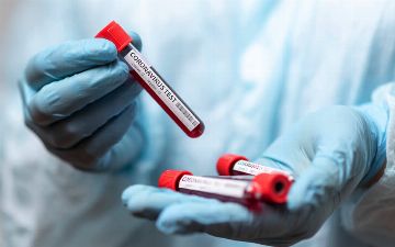 Число умерших от коронавируса в нашей стране достигло 670 человек