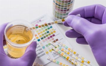 В ближайшем будущем врачи будут диагностировать сотрясение мозга с помощью анализа мочи