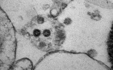 США захвачен омикрон-штаммом коронавируса — подробности