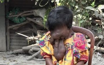 Этой женщине всего 23 года — рассказываем, что с ней случилось