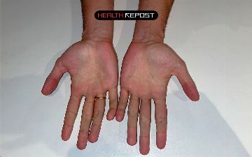 Почему кровь красная, а вены синие?