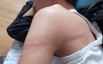 В Андижане преподаватель избил ученика линейкой — фото