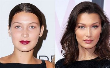 Что такое комки Биша и зачем их удаляют селебрити