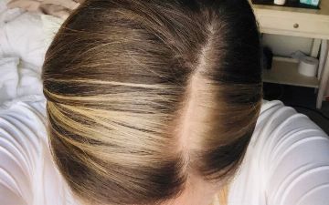 Жительница Англии родила ребенка с разноцветными волосами и ресницами — рассказываем, что это за диагноз и как с ним жить