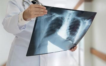 Сколько зараженных пневмонией узбекистанцев было зарегистрировано за прошедшие сутки?