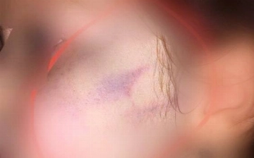 В Ташобласти воспитательница частного детсада избила двухлетнюю девочку